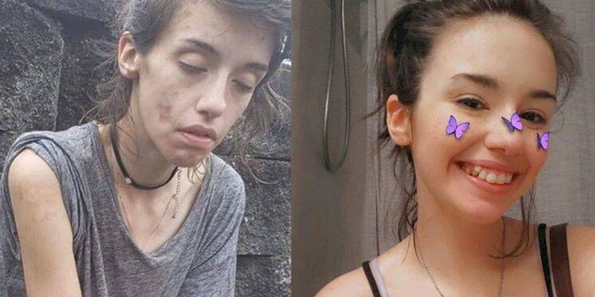 Una chica subió su foto "antes y después" para mostrar cómo se recuperó de la adicción a las drogas | Internacionales