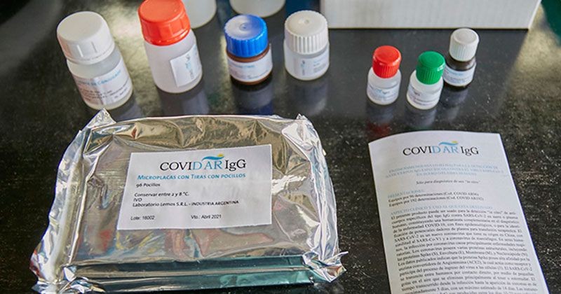 La producción del test serológico argentino para coronavirus llegó a los 100.000 ensayos | Actualidad