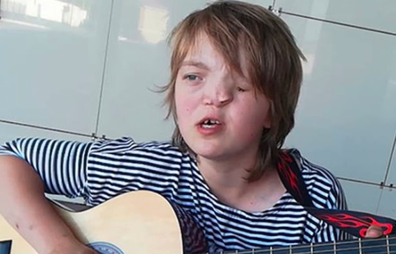 Su padre la abandonó porque nació con media cara: ahora lo busca en las redes para reencontrarse | Internacionales