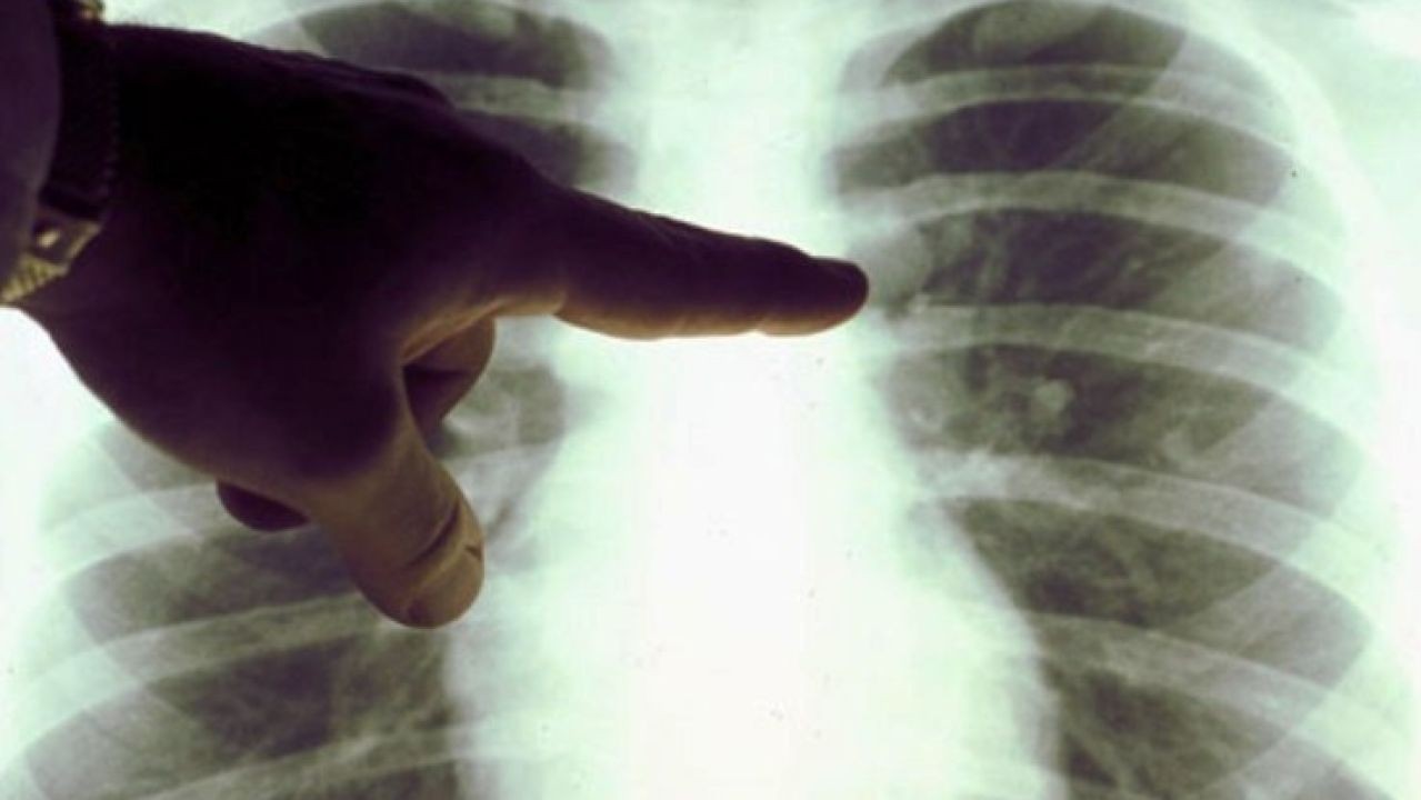 Científicos logran recuperar pulmones humanos dañadas tras "conectarlos" a cerdos vivos | Internacionales
