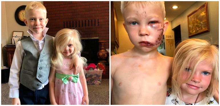 Pequeño gran héroe: un chico de 6 años salvó a su hermana del ataque de un perro | Curiosidades