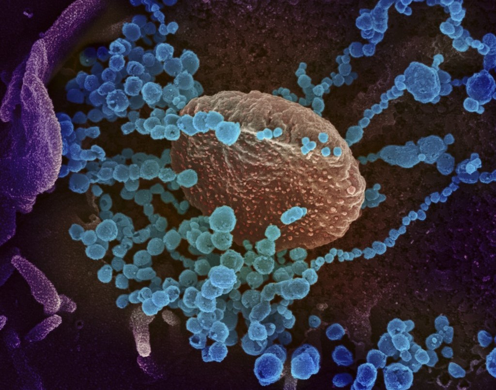 Coronavirus: investigadores preparan un método que podría reducirlo a un resfriado común | Internacionales