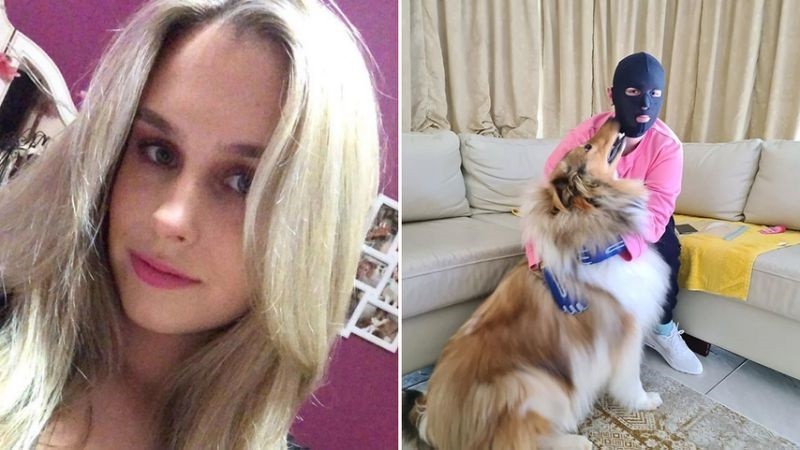 Muestra en Instagram la dolorosa recuperación tras sobrevivir a la erupción de un volcán | Internacionales