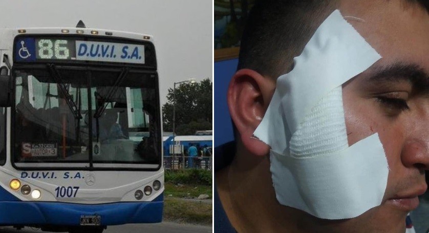 Colectivero tuvo coronavirus, se repuso, volvió a trabajar y lo apuñalaron para robarle | Actualidad