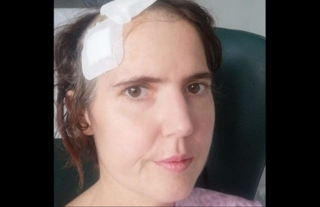 Empezó con un dolor en la muela de juicio y casi muere por una infección cerebral | Curiosidades