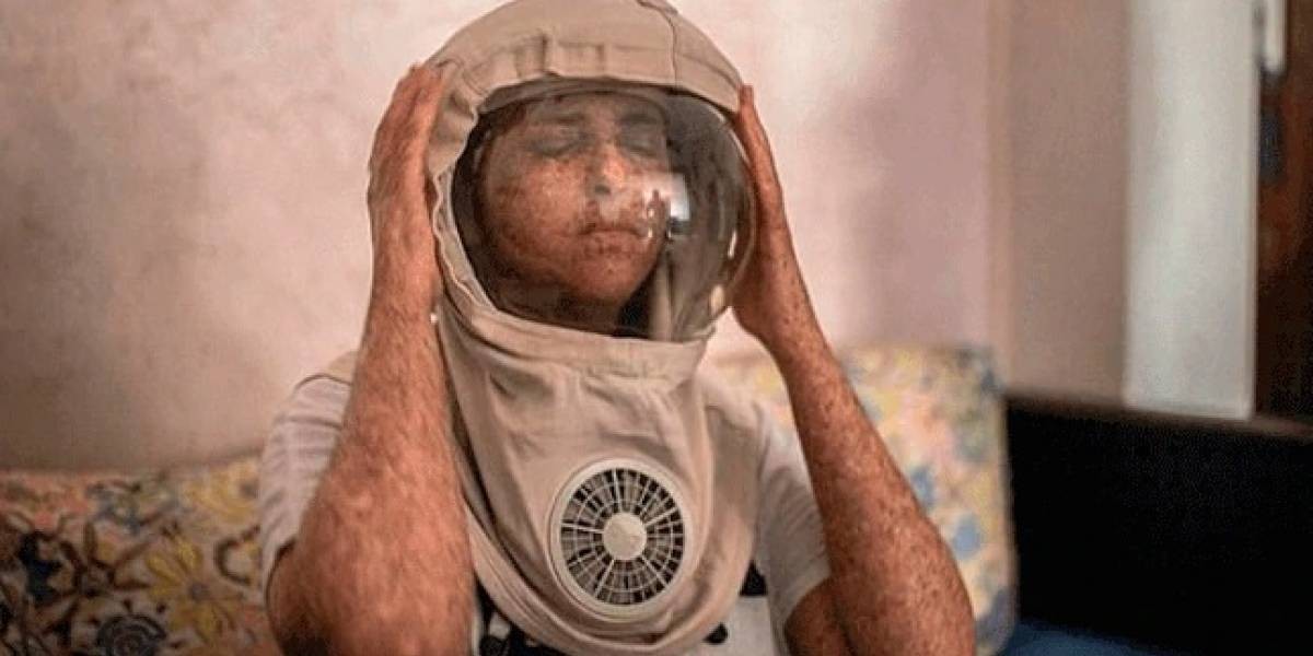 La mujer que vive de noche o con casco de astronauta porque es alérgica al sol | Curiosidades