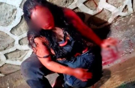 Decapitó a su marido e intentó huir con la cabeza | Internacionales