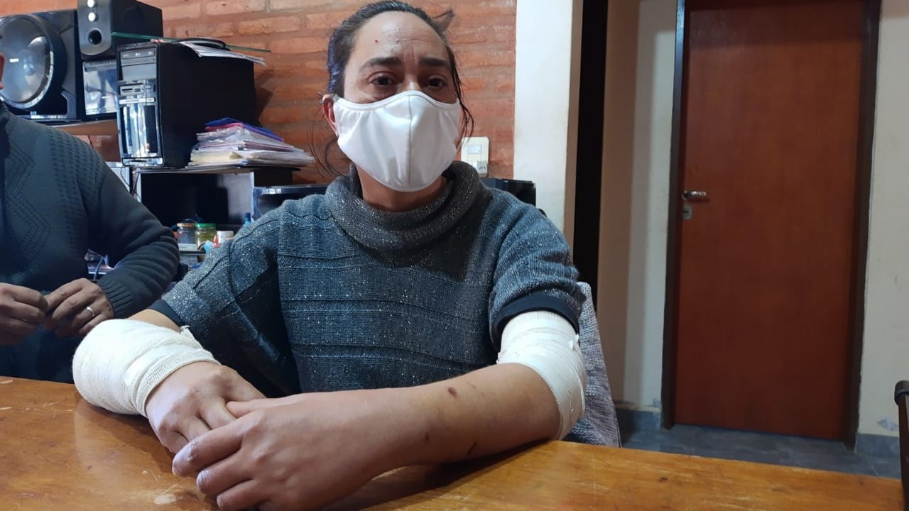 Feroz ataque de cinco perros a una mujer: “el casco de la moto le salvó la vida” | Actualidad