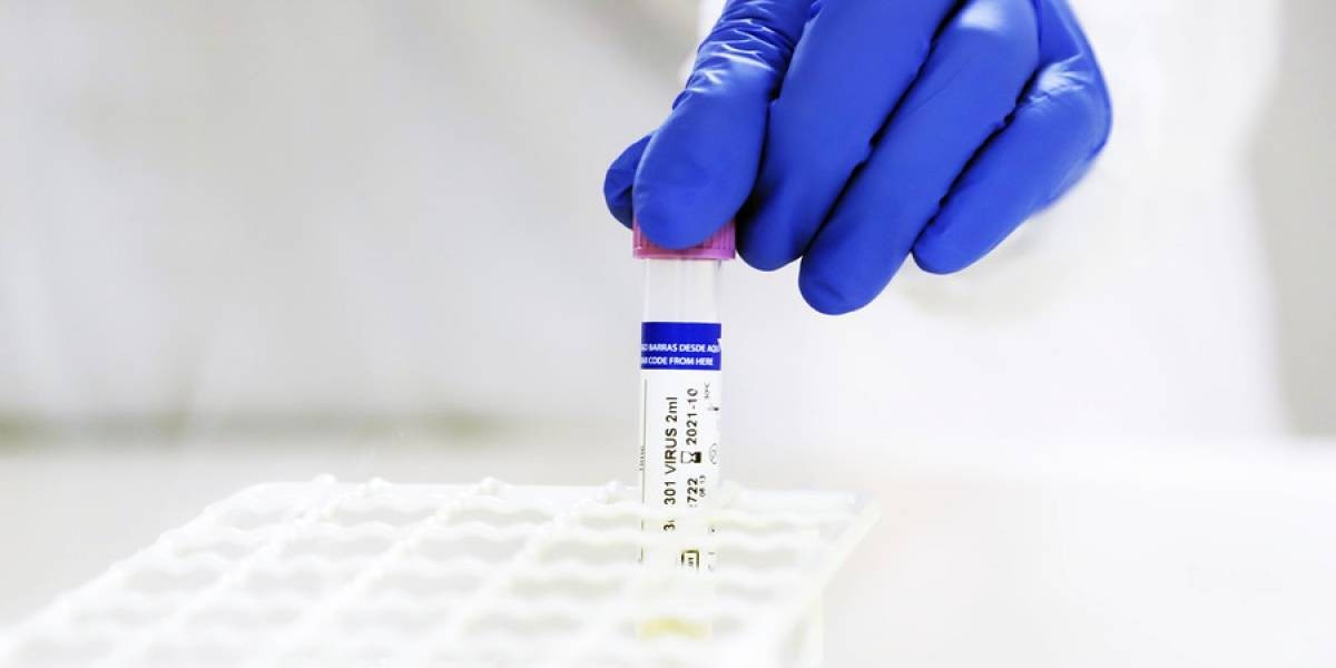 Científicos ven señales de "inmunidad duradera" tras una infección de coronavirus | Internacionales