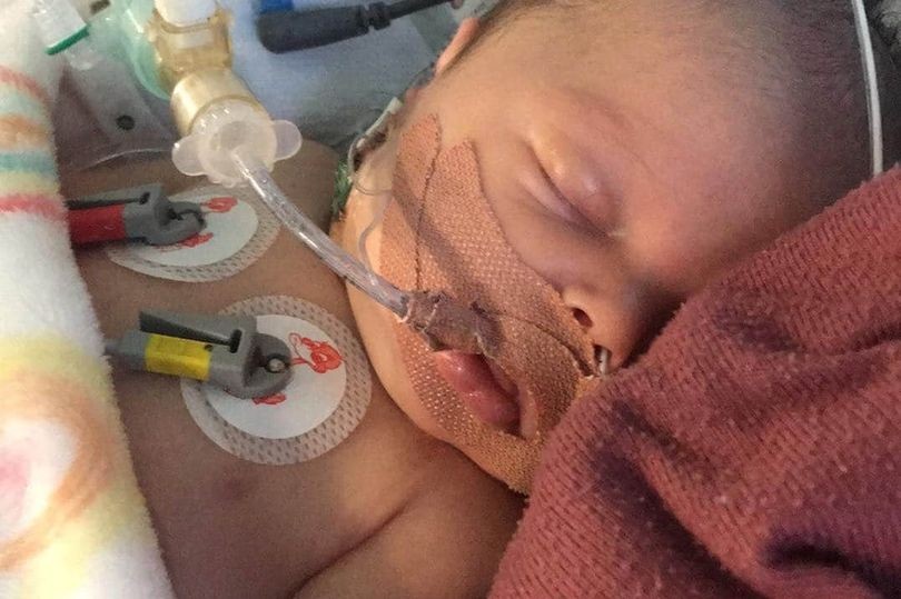 El bebé que tuvo tres paros cardíacos por culpa de una gota de leche | Internacionales