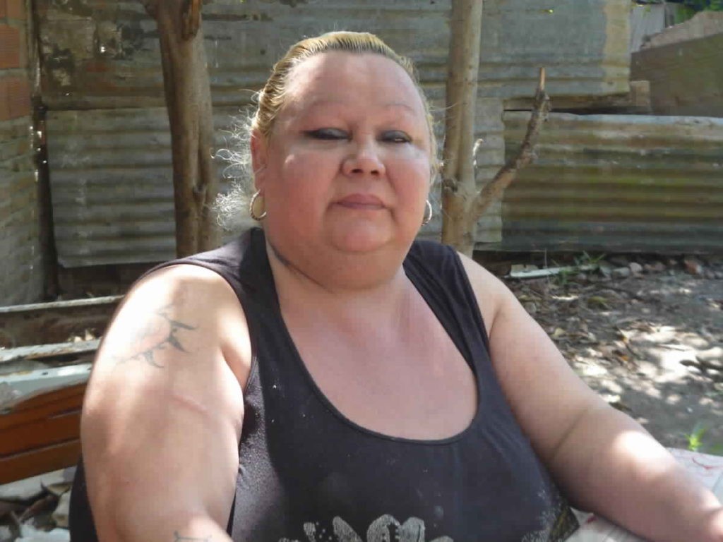 Mala praxis: Le inyectaron aceite de avión y pide ser operada urgente para calmar los dolores | Actualidad