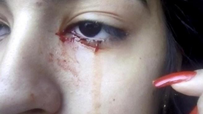 Misterio por la chica de 15 años que llora lágrimas de sangre | Redes