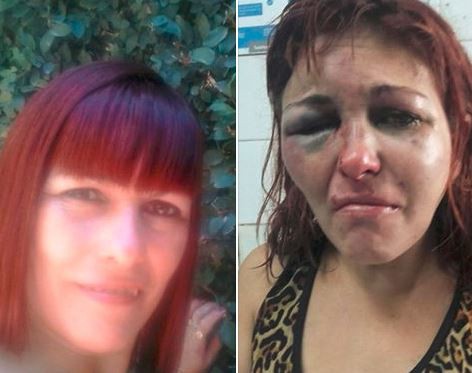 Escapó de la brutal golpiza de su pareja y se salvó de milagro | Actualidad