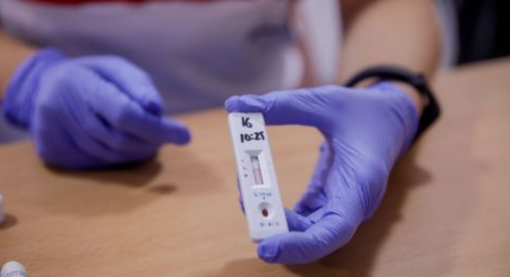 Lanzarán test de antígenos que permite diagnosticar el covid-19 en 18 minutos | Actualidad