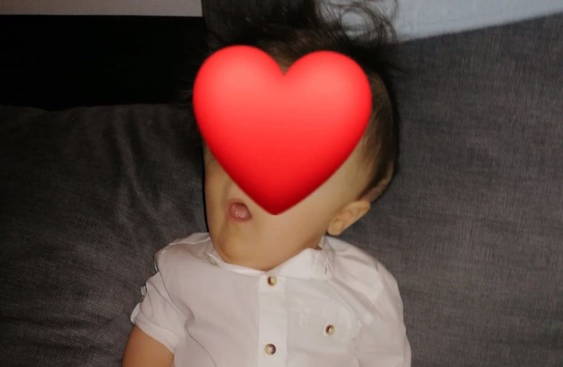 Cumplió un año Rodrigo, el "bebé sin rostro" que nació sin ojos ni nariz | Internacionales