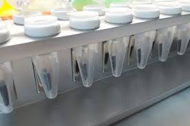 Desarrollan un kit que extrae el gen del coronavirus con nanopartículas como imán | Actualidad