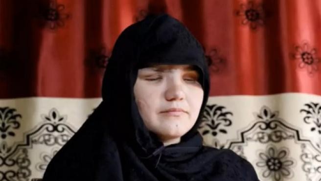 Le arrancaron los ojos a una mujer por trabajar fuera de su casa en Afganistán | Internacionales