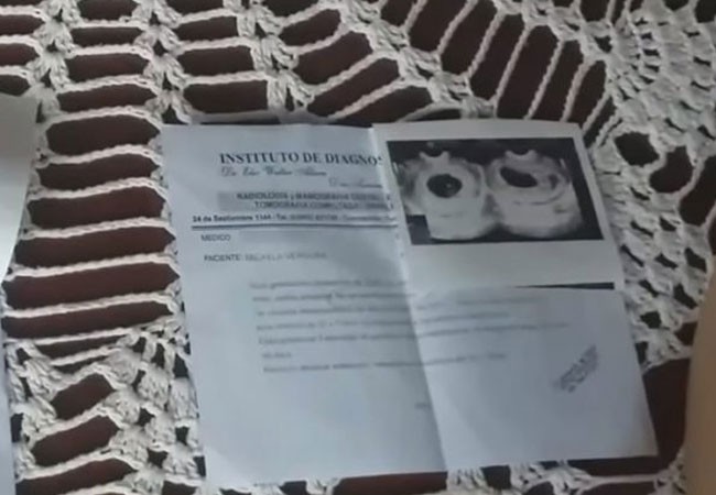 "Hace un mes tengo a mi bebé sin vida en mi panza": no puede pagar los $25 mil de la operación | Actualidad