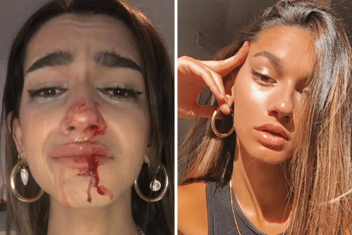 Una influencer trans sufrió una brutal golpiza en la calle | Actualidad