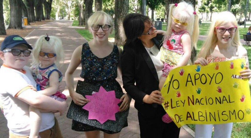 Buscan que Argentina sea el primer país en proteger los derechos de los albinos | Actualidad