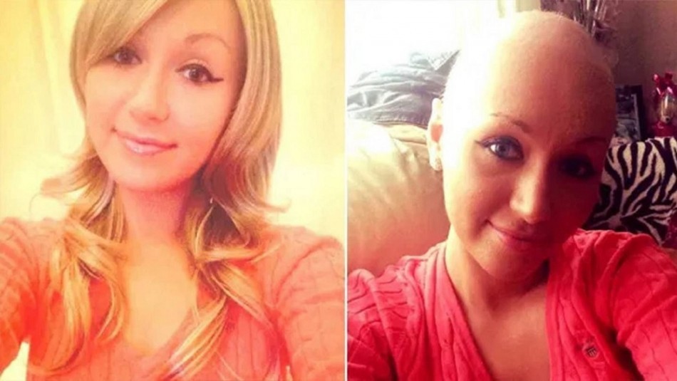 Murió de cáncer a los 23 años después de que le negaron 15 veces un examen | Internacionales