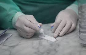 Estados Unidos homologa un test que mide los anticuerpos contra el coronavirus | Internacionales