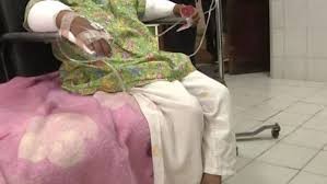 Una mujer quemó las manos de su hija de 6 años por robar golosinas | Internacionales