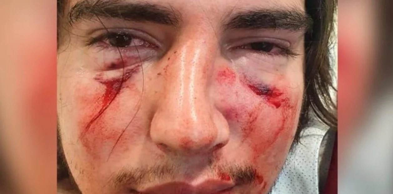 Rugbiers acusados por golpiza a un joven en Córdoba: el comunicado de la UAR | Actualidad