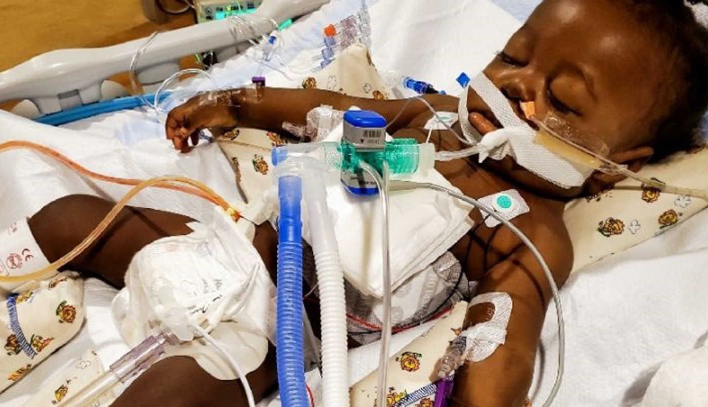 El "bebé milagro" que superó el coronavirus y un trasplante de hígado | Internacionales