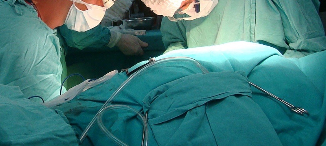 Trasplantes de córneas: tras un año de espera por la pandemia, dos pacientes recuperan la visión | Actualidad