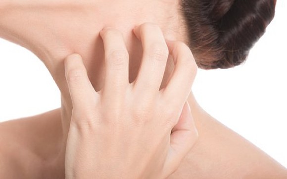 Campaña para detectar una rara enfermedad en la piel que afecta a medio millón de argentinos | Actualidad