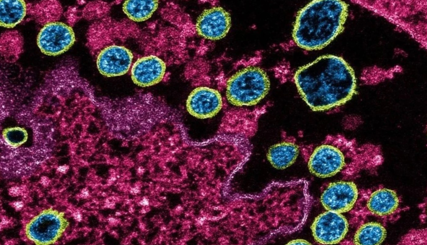 Un hallazgo confirma que es posible infectarse con dos variantes de coronavirus al mismo tiempo | Internacionales