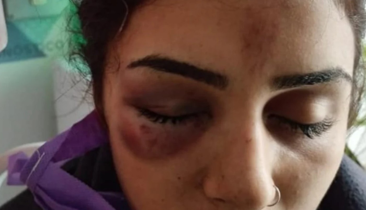 La sorprendieron de atrás tres chicas y la molieron a golpes: tiene fractura de cráneo | Actualidad