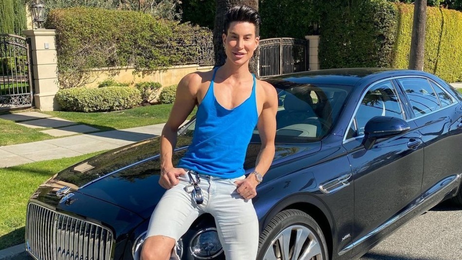 El "Ken humano" llegó a su cirugía plástica número 1.000 | Curiosidades