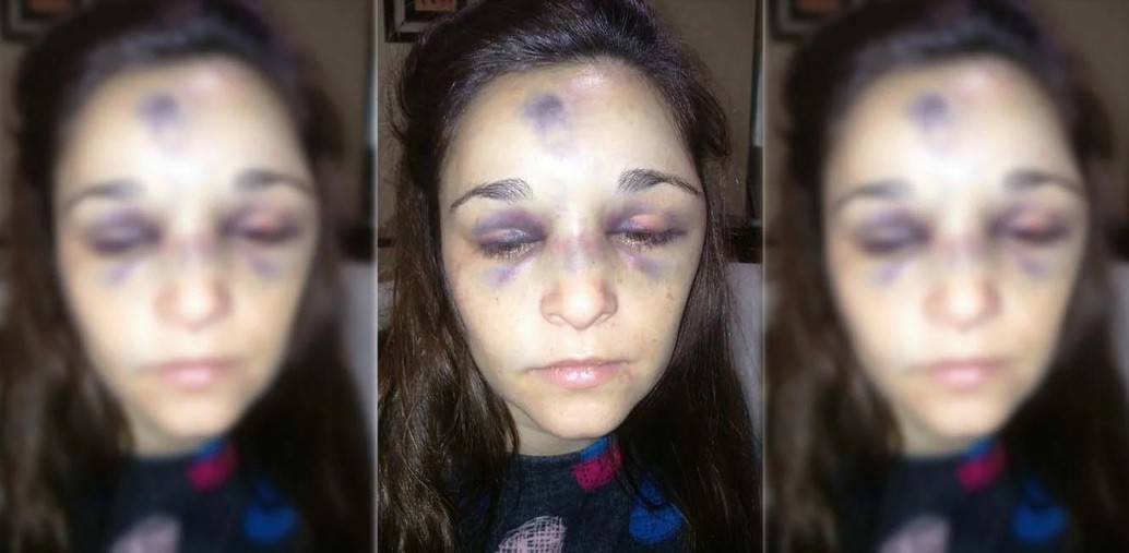 Está muy grave una mujer que fue golpeada por su pareja, un boxeador de 17 años | Actualidad