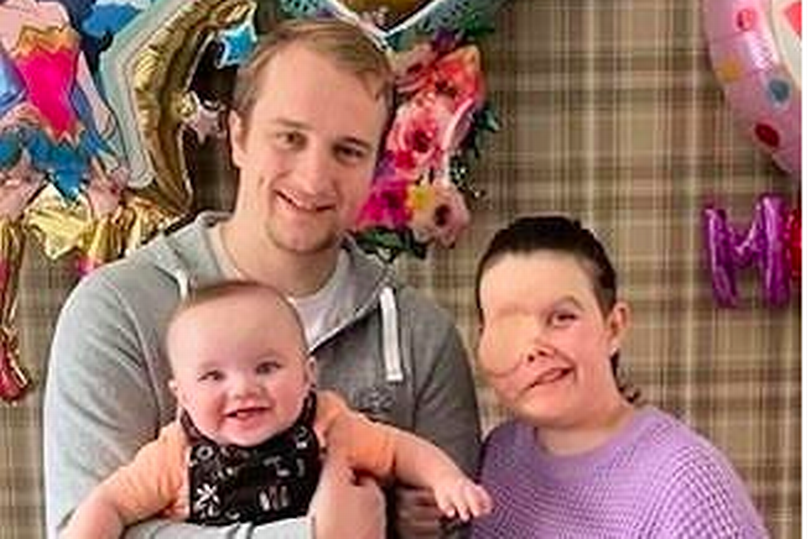 Una joven madre descubrió que tenía un raro tipo de cáncer porque le lloraba un ojo | Internacionales