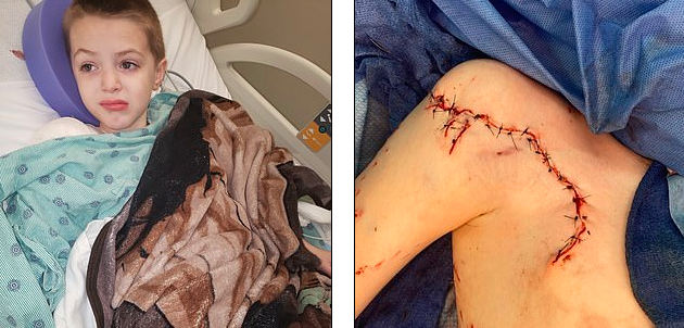 Un nene de 9 años fue atacado por un tiburón en Miami | Internacionales