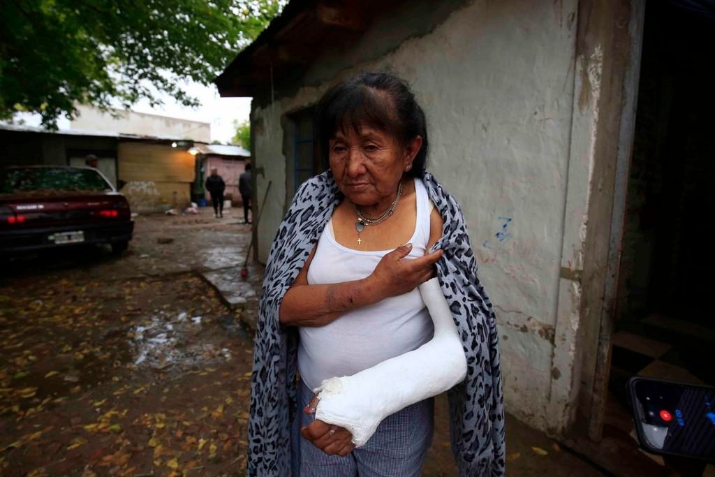 "Si gritás, te quemamos": le entraron a robar a su casa y le quebraron el brazo | Actualidad