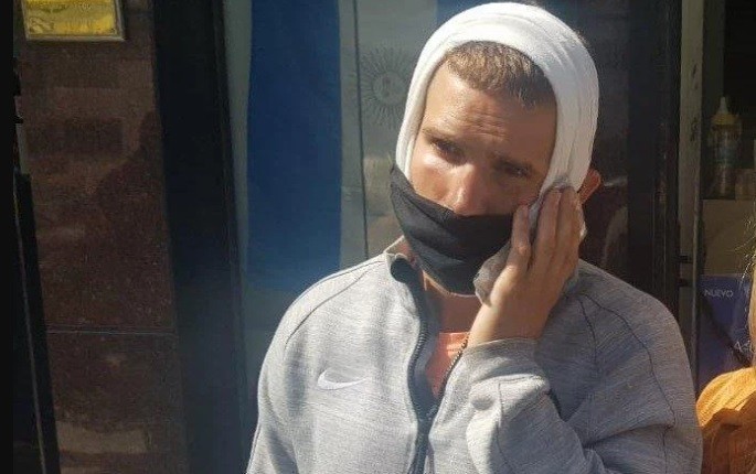 Denunció que le dieron una paliza en un boliche: "Eran seis patovicas contra mi" | Actualidad