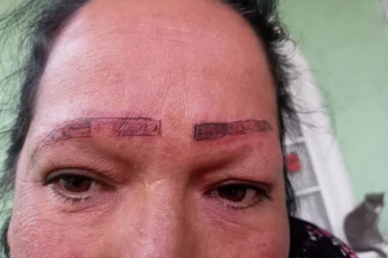 Se viralizó la denuncia de una joven por tatuadores que la estafaron y le arruinaron la cara | Internacionales
