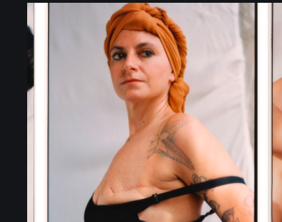 Lanzaron una linea de corpiños y mallas para mujeres con un solo pecho | Internacionales