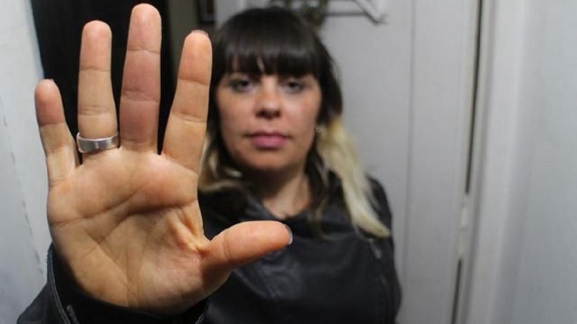 Doblaba la ropa en su casa, la picó una araña y estuvo 2 días internada | Actualidad