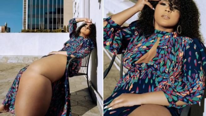 Una influencer con linfedema recibe crueles comentarios sobre su condición: "Por qué no te amputas la pierna" | Internacionales