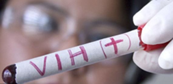 "En la Argentina el 17% de las personas que viven con VIH no lo saben", sostiene el Dr. Cahn | Actualidad