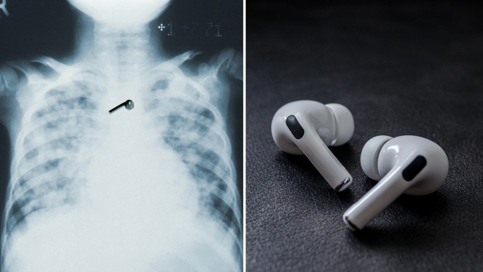 Se quedó dormido y se tragó uno de sus AirPods: los auriculares aún funcionan | Internacionales