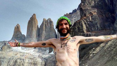 El hombre que vive sin colon, sin recto y sin estómago: "Estoy vacío por dentro y quiero llenarme de aventuras" | Internacionales