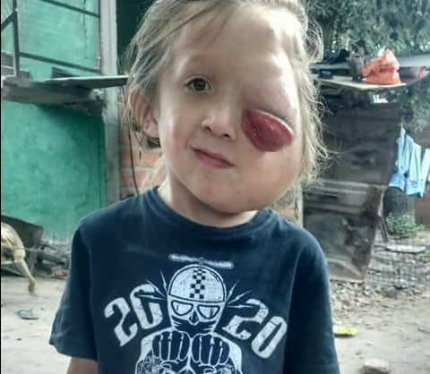 Todos por Tobías: tiene un gran tumor en la cara y necesita ayuda para pagar su tratamiento | Actualidad