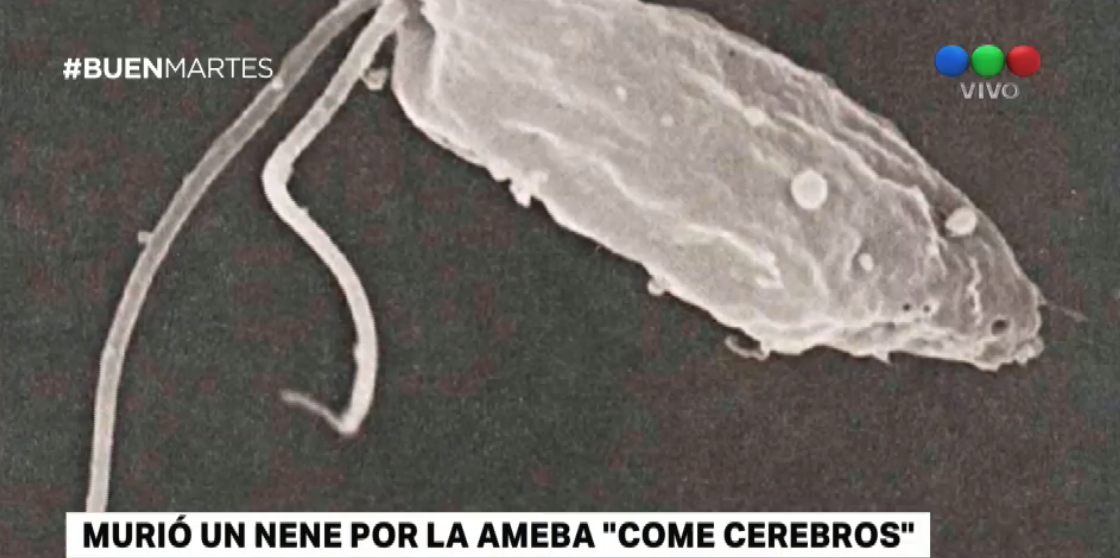 Un nene de 8 años murió por la ameba "come cerebros" | Actualidad