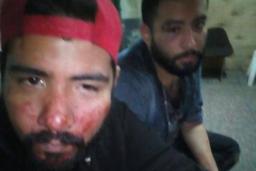 Feroz paliza a una pareja gay en Quilmes | Actualidad
