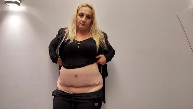 Tuvo que vender su camioneta para pagar una cirugía estética y ahora vive un infierno | Actualidad